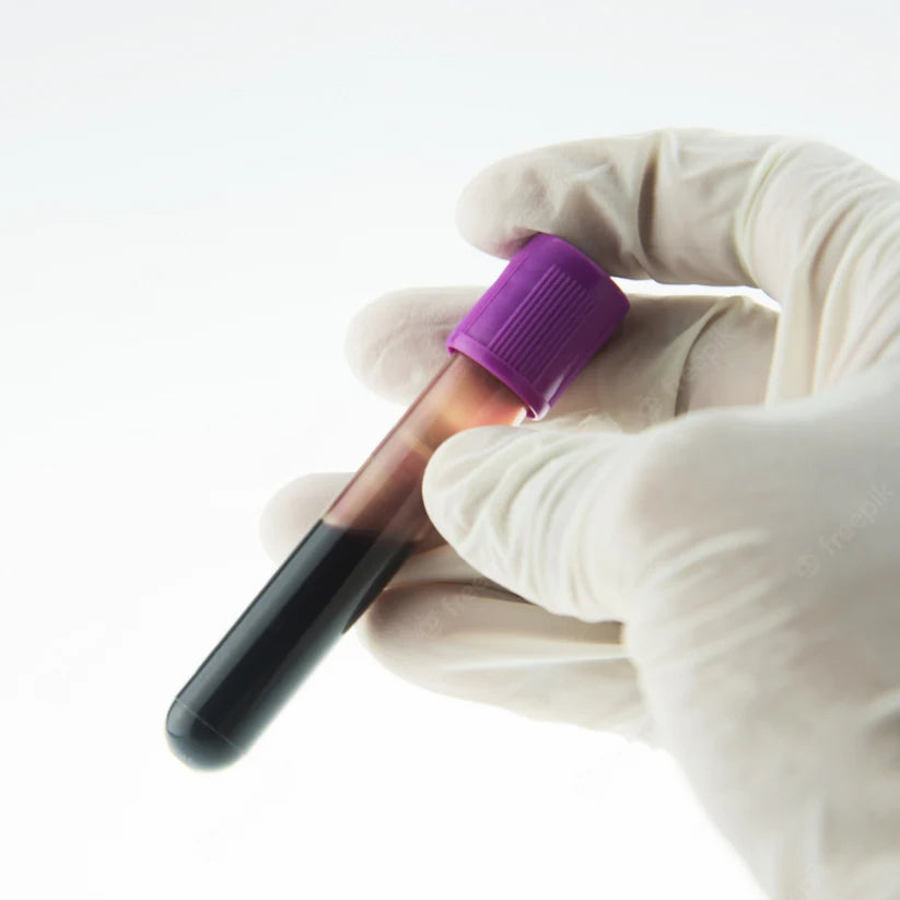 Calreticulina (CALR)