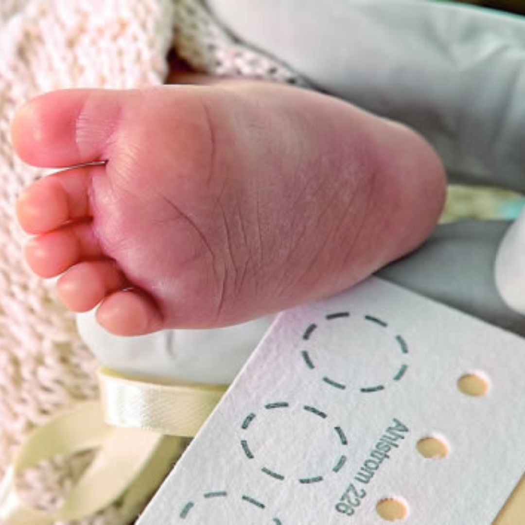 TSH neonatal (tamizaje)