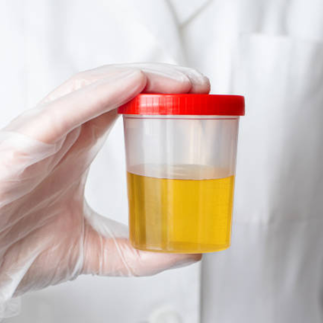 Antidoping de 6 elementos