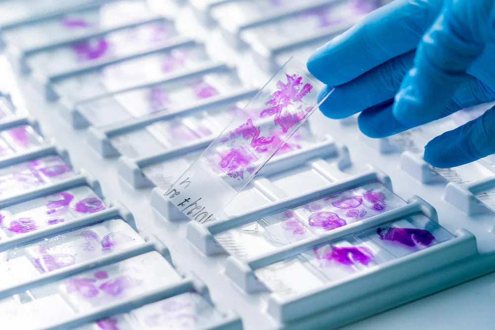 Biopsias e histopatología