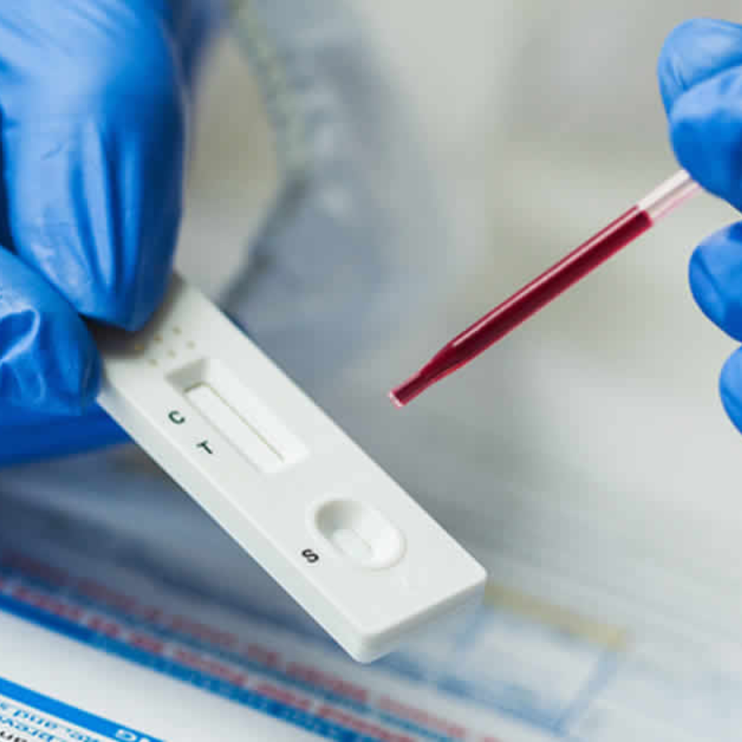 Prueba de Hepatitis B (Presuntiva)