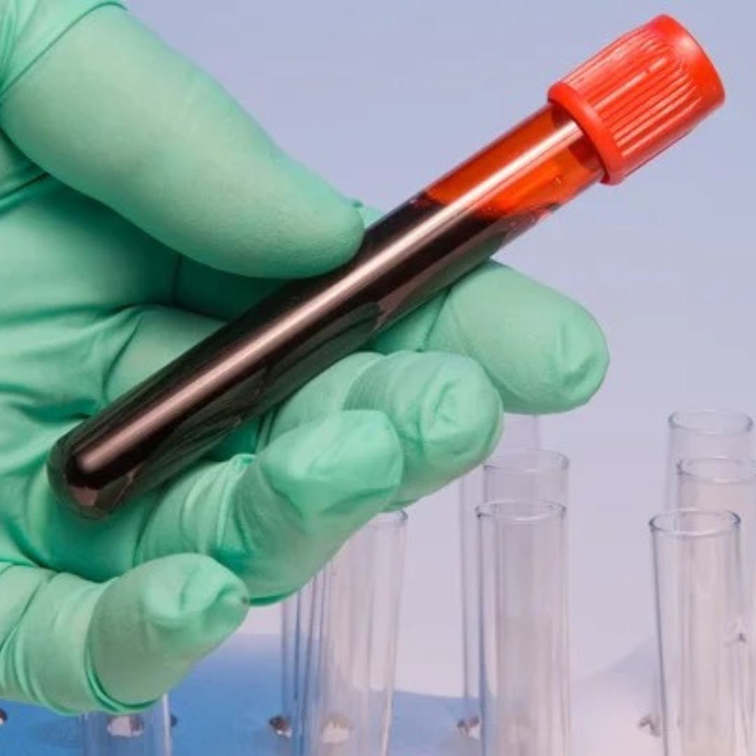 Antígeno Carcinoembrionario (CEA)