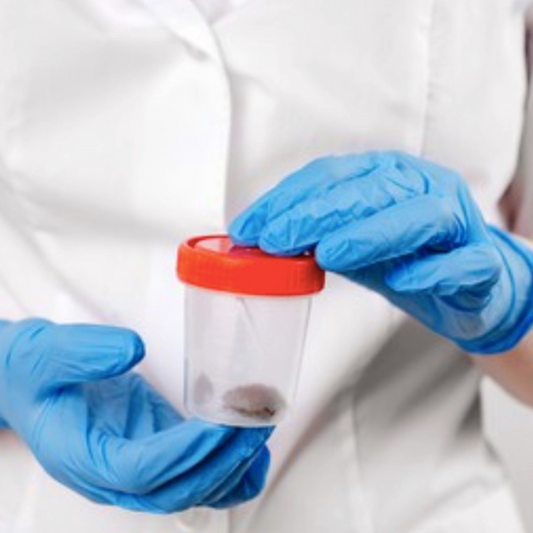 Sangre oculta en heces